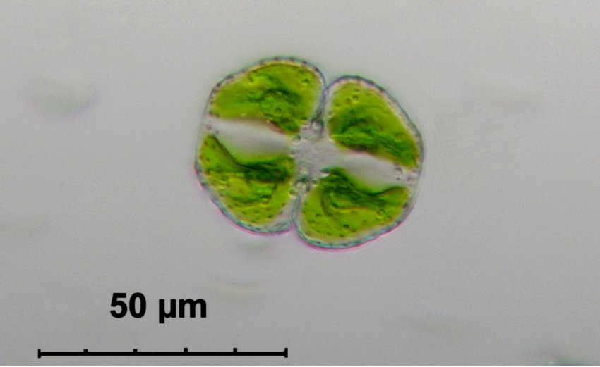 Cosmarium botrytis ? vari passaggi